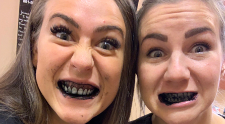 Debunking DIY Teeth Whitening Trends Activated Charcoal Oil